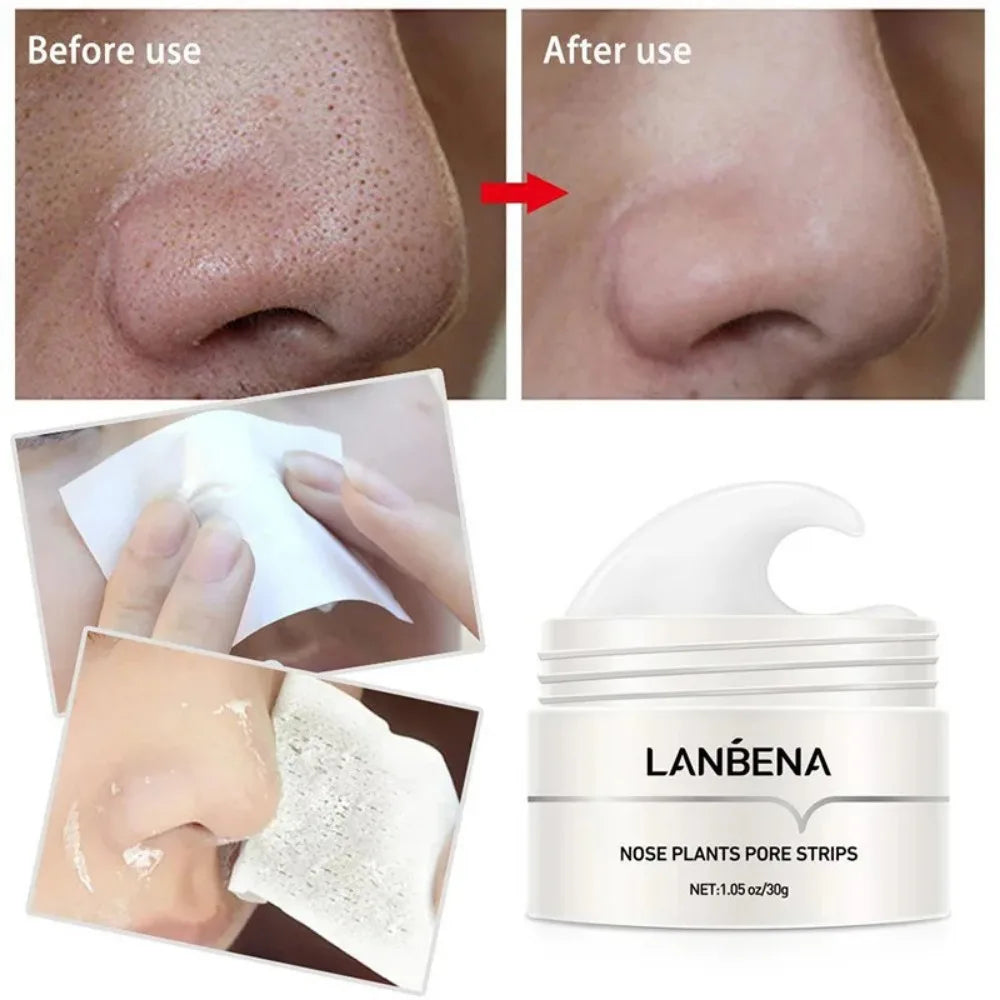Deep Cleansing Blackhead Remover Mask - Pore Strips for Clear Skin and Acne Control