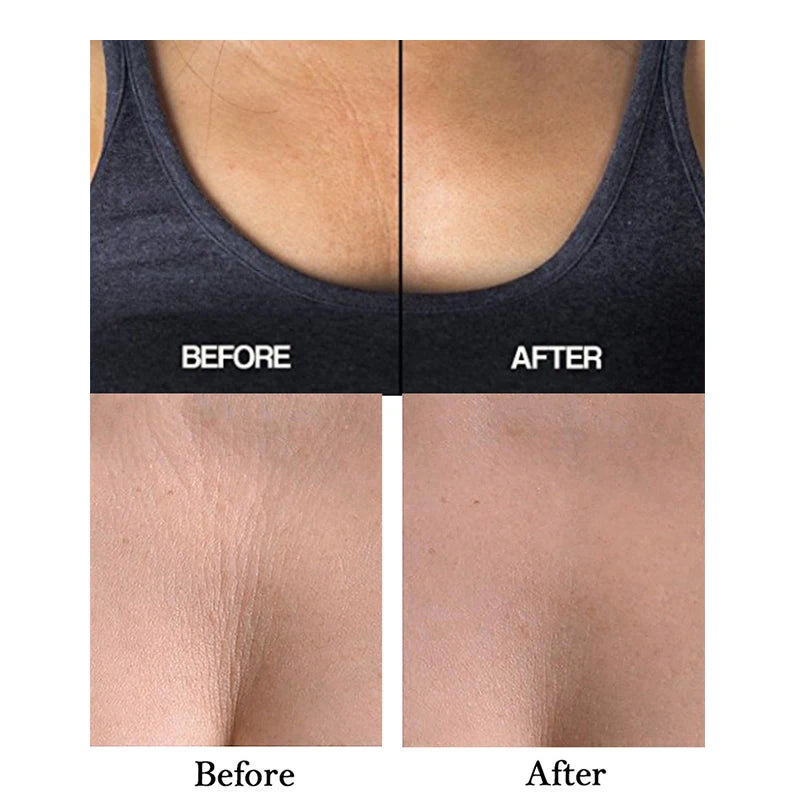 Revitalize Your Skin with Reusable Anti-Wrinkle Chest Pads - Silicone Lift & Firm Neck Patches