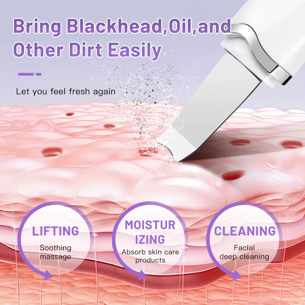 Revitalize Your Skin: Electric Ultrasonic Face Scrubber for Deep Cleansing and Blackhead Removal