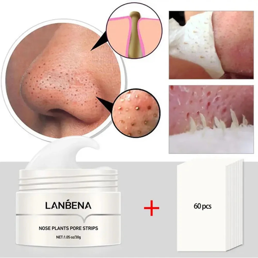Deep Cleansing Blackhead Remover Mask - Pore Strips for Clear Skin and Acne Control