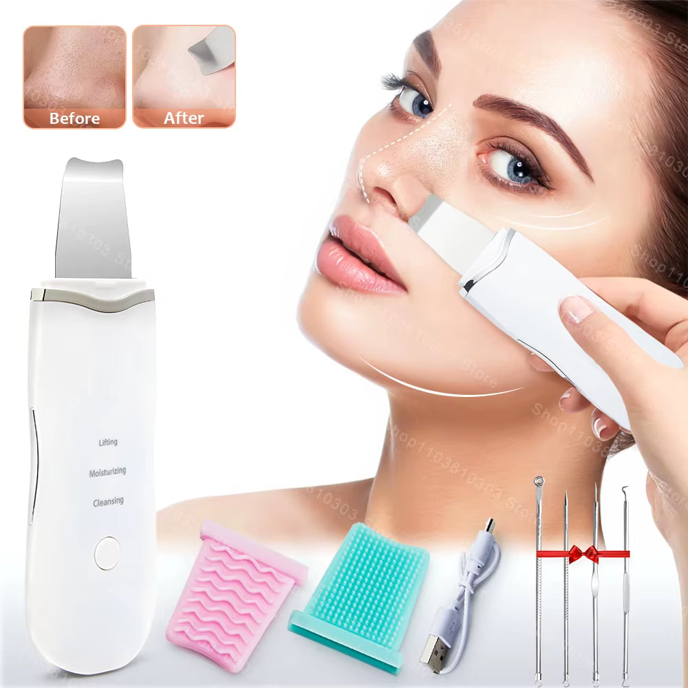 Revitalize Your Skin: Electric Ultrasonic Face Scrubber for Deep Cleansing and Blackhead Removal