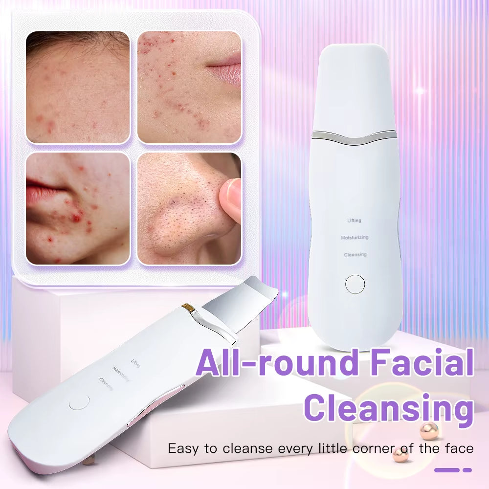 Revitalize Your Skin: Electric Ultrasonic Face Scrubber for Deep Cleansing and Blackhead Removal