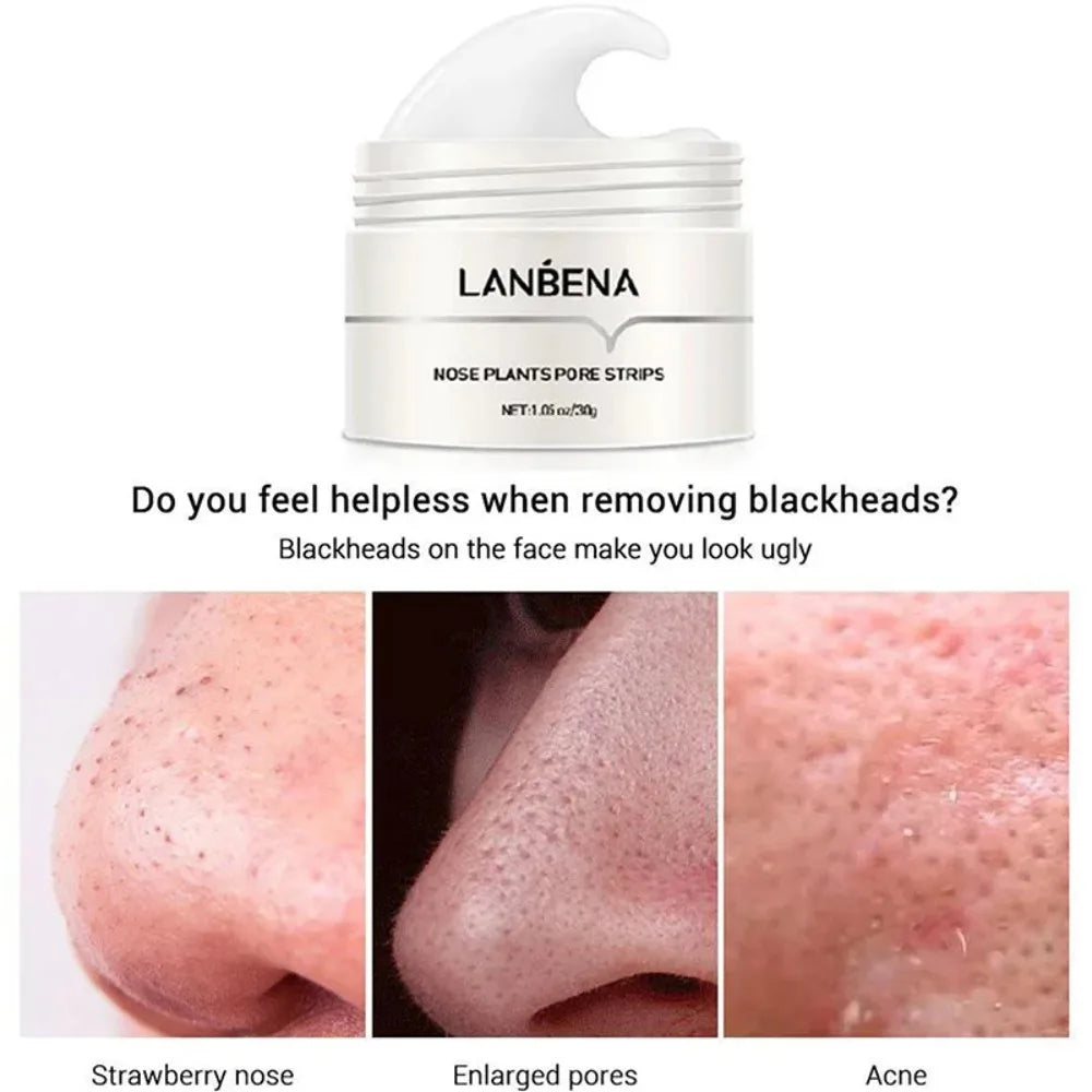 Deep Cleansing Blackhead Remover Mask - Pore Strips for Clear Skin and Acne Control