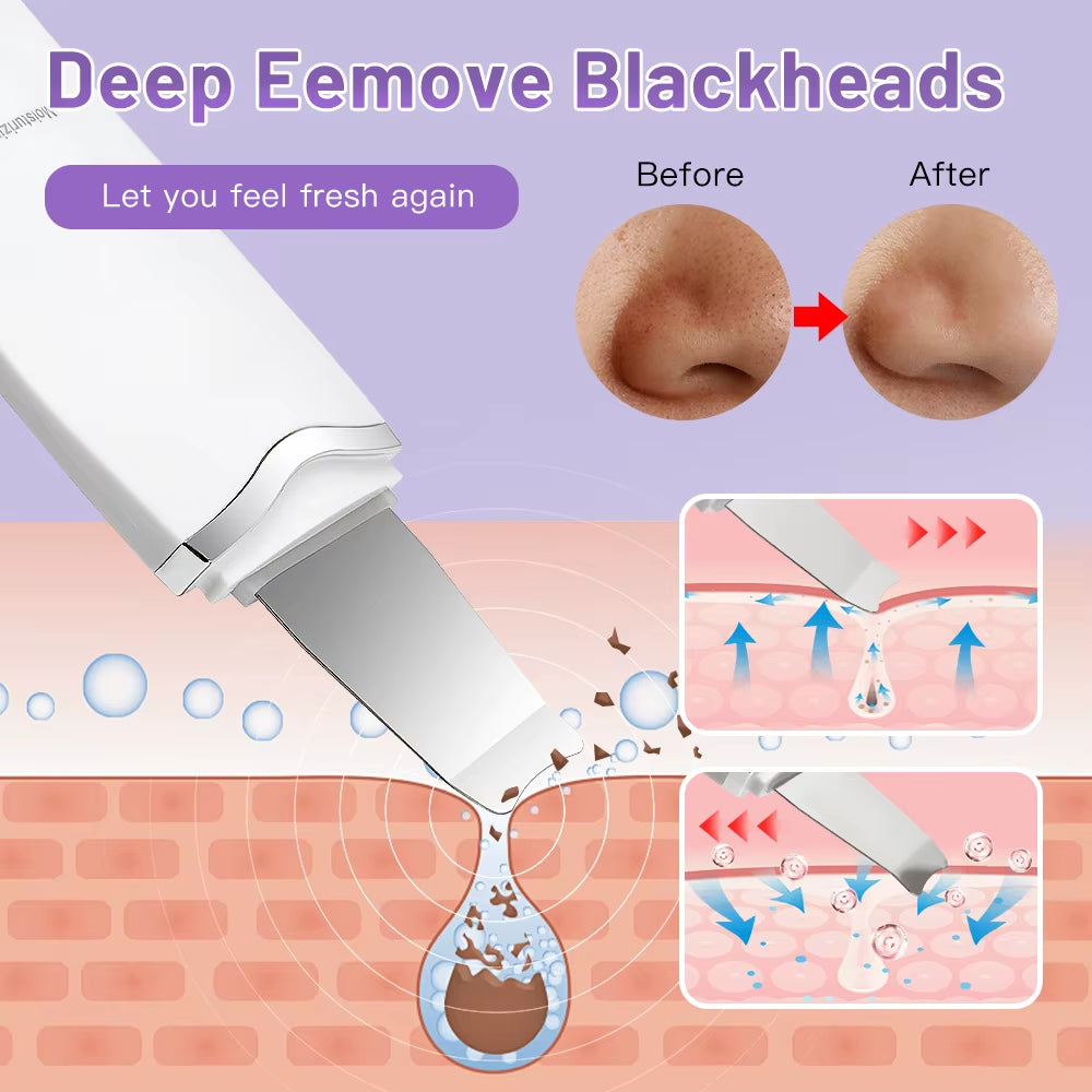 Revitalize Your Skin: Electric Ultrasonic Face Scrubber for Deep Cleansing and Blackhead Removal